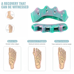 HYGGEAR Großzehen-Bunion-Korrektor (Hallux Valgus).