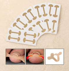 Hyggear Set de uñas encarnadas con tiras transpirables para uñas encarnadas