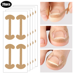 Hyggear Set de uñas encarnadas con tiras transpirables para uñas encarnadas
