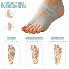 Hyggear Bunion Corrector [Big Toe, Halux Valgus]