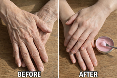Hyggear™ DermaRestore for Saggy Arms - 73287547632